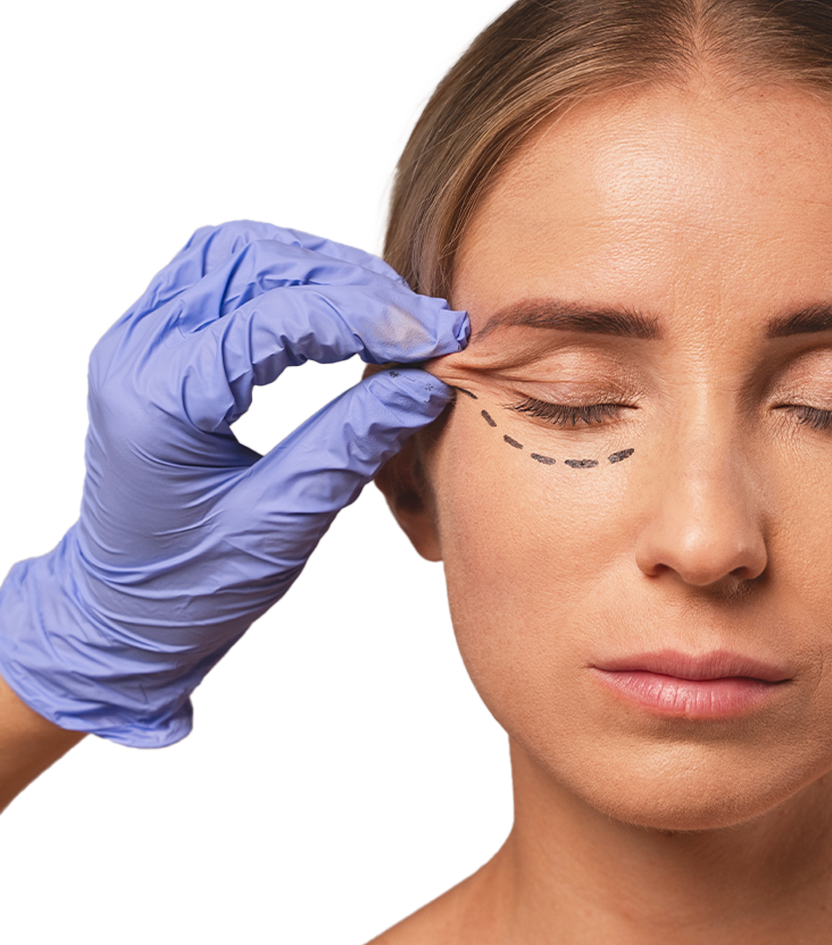Face lift Lifting viso