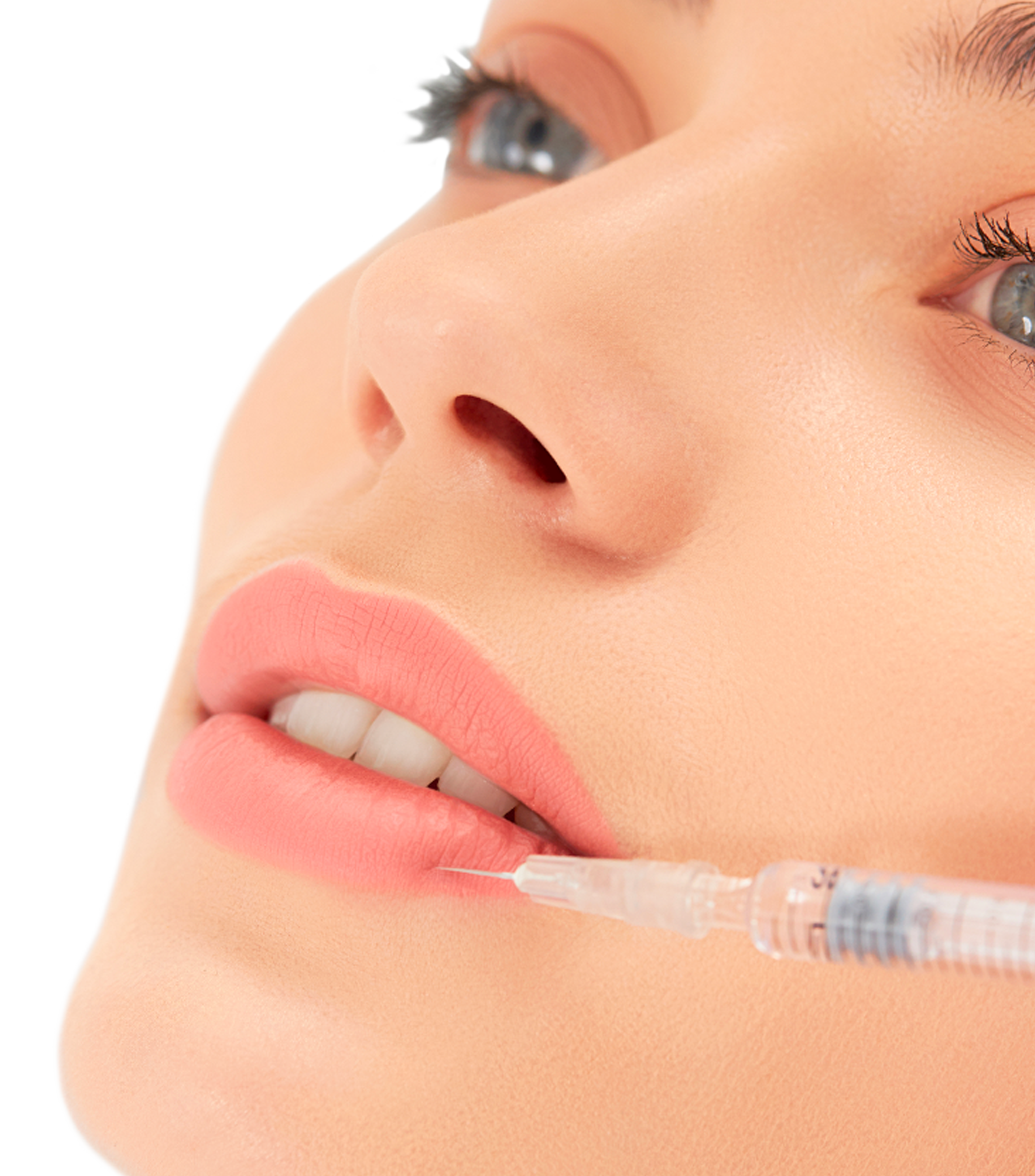 Lip Lifting