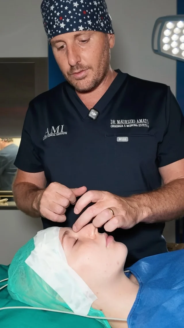 “Bellissimo Dottore! Grazie mille.” ♥️

Rinosettoplastica eseguita in anestesia locale con tecnica chiusa, senza alcuna cicatrice visibile.

L’intervento ha corretto sia la parte funzionale e respiratoria sia quella estetica.
La naturalezza del risultato si apprezza già ora nell’immediato, anche se il gonfiore si ridurrà gradualmente nei prossimi mesi.

Guarda il video per vedere il risultato subito dopo l’intervento.

📞 +39 392 1383817
📍Amato Medical Institute - Via Fiorelli 12, Napoli
📬 info@maurizioamato.com
🌍 www.maurizioamato.com

#chirurgoplastico #rinoplastica #plasticsurgeryclinic #nosesurgery #naturalresults
